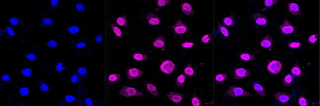SYNE3 Antibody in Immunocytochemistry (ICC/IF)