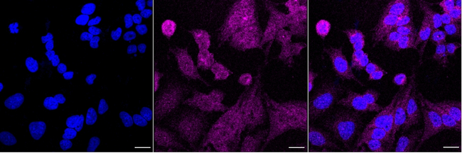 IL11RA Antibody in Immunocytochemistry (ICC/IF)
