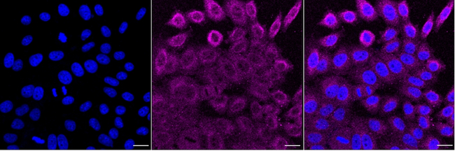RAB8A Antibody in Immunocytochemistry (ICC/IF)