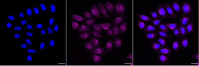 SFRP4 Antibody in Immunocytochemistry (ICC/IF)