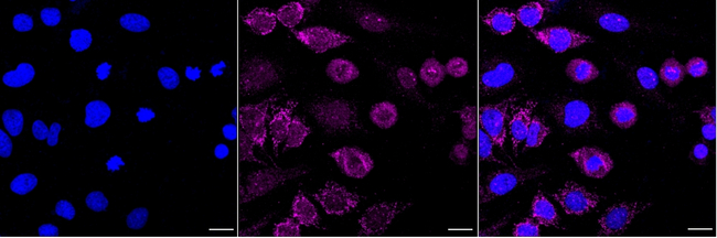 Synapsin II Antibody in Immunocytochemistry (ICC/IF)