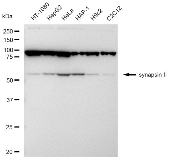 Synapsin II Antibody in Western Blot (WB)