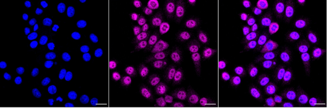 TBLR1 Antibody in Immunocytochemistry (ICC/IF)