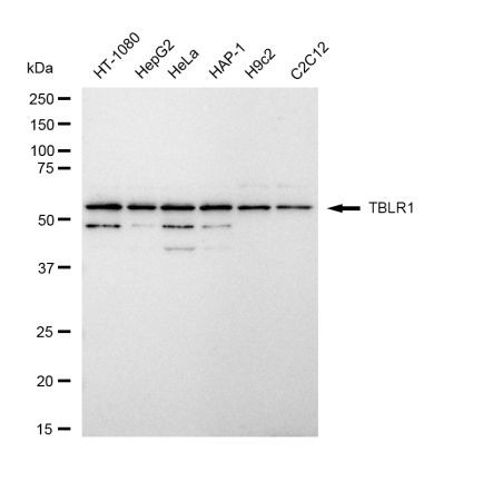 TBLR1 Antibody in Western Blot (WB)