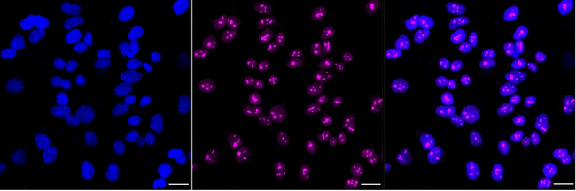 XBP1 Antibody in Immunocytochemistry (ICC/IF)