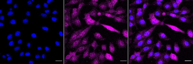 ALDH2 Antibody in Immunocytochemistry (ICC/IF)