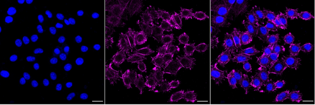 ATG10 Antibody in Immunocytochemistry (ICC/IF)