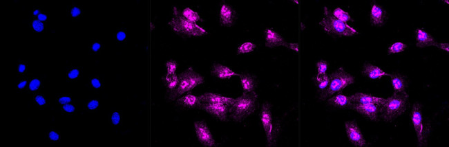 BAG2 Antibody in Immunocytochemistry (ICC/IF)