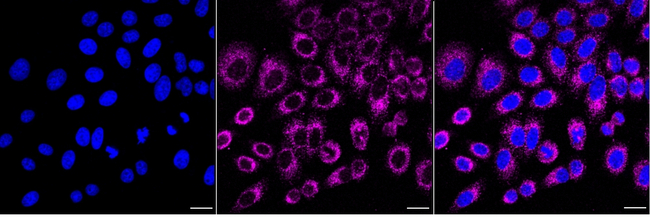 BMP-4 Antibody in Immunocytochemistry (ICC/IF)