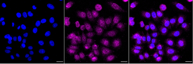 GSTM1 Antibody in Immunocytochemistry (ICC/IF)