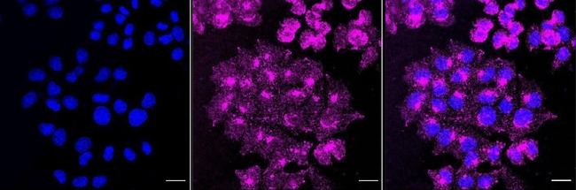 Caveolin 2 Antibody in Immunocytochemistry (ICC/IF)