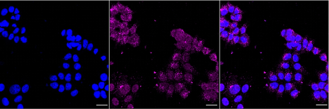 CDCA3 Antibody in Immunocytochemistry (ICC/IF)