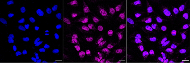 Chromogranin B Antibody in Immunocytochemistry (ICC/IF)