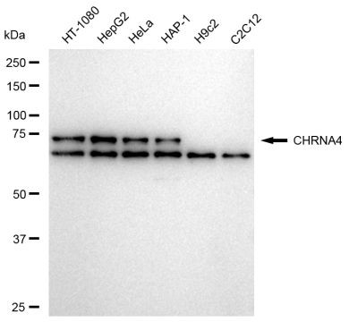CHRNA4 Antibody in Western Blot (WB)