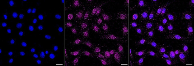 Mast Cell Chymase Antibody in Immunocytochemistry (ICC/IF)