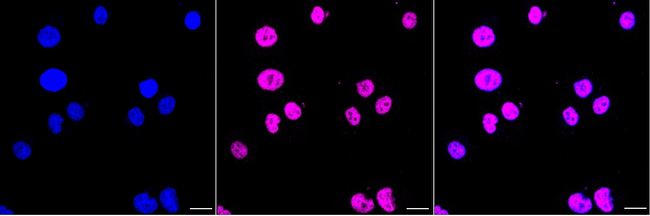 COL11A1 Antibody in Immunocytochemistry (ICC/IF)