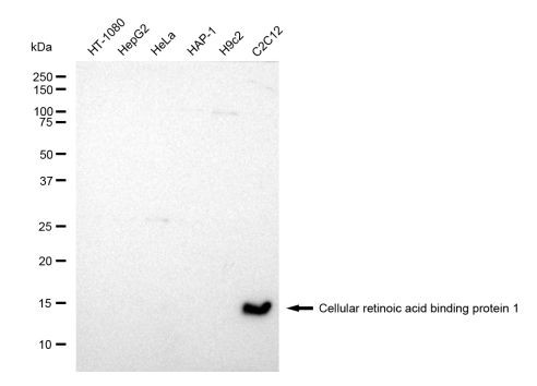 CRABP1 Antibody in Western Blot (WB)