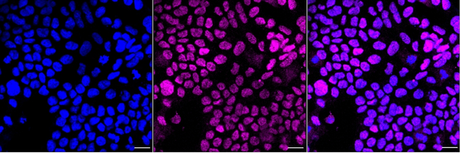 CtBP1 Antibody in Immunocytochemistry (ICC/IF)