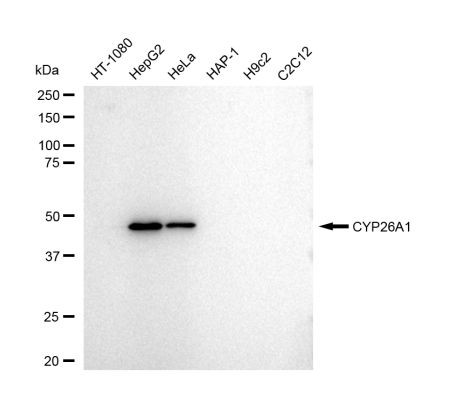 CYP26A1 Antibody in Western Blot (WB)