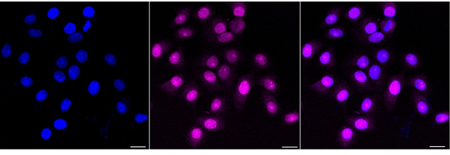 Drebrin Antibody in Immunocytochemistry (ICC/IF)