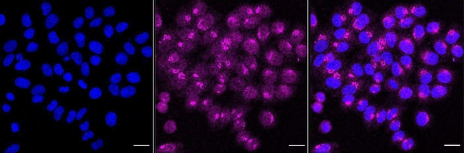 RCL Antibody in Immunocytochemistry (ICC/IF)