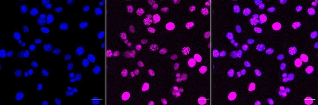 DOK1 Antibody in Immunocytochemistry (ICC/IF)