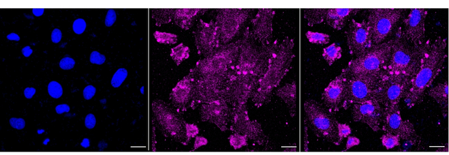 DPYD Antibody in Immunocytochemistry (ICC/IF)