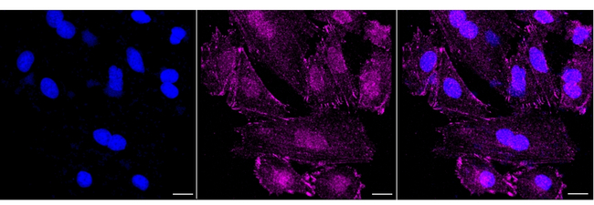 Destrin Antibody in Immunocytochemistry (ICC/IF)