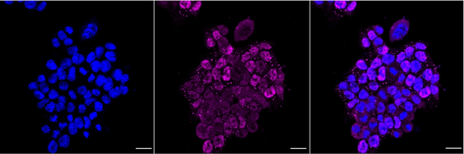 E2F2 Antibody in Immunocytochemistry (ICC/IF)