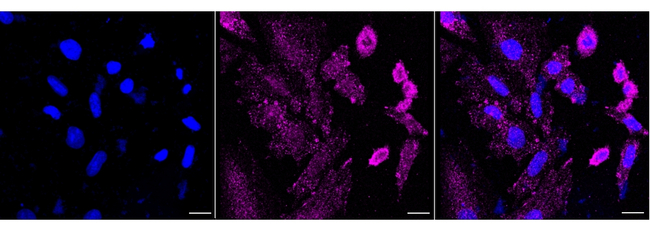PHD3 Antibody in Immunocytochemistry (ICC/IF)