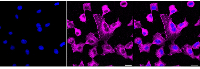EHD1 Antibody in Immunocytochemistry (ICC/IF)