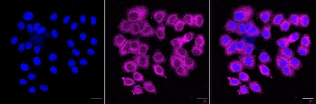 eIF2b epsilon Antibody in Immunocytochemistry (ICC/IF)