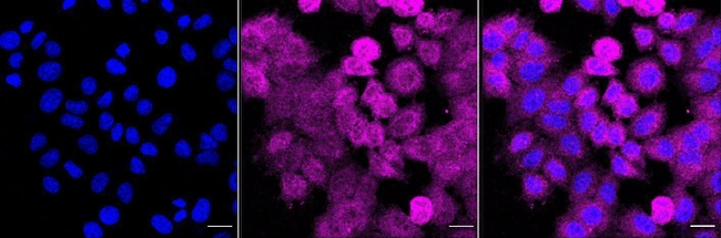 EXOC3 Antibody in Immunocytochemistry (ICC/IF)