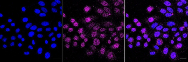 FANCA Antibody in Immunocytochemistry (ICC/IF)
