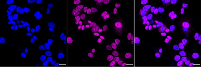FANCD2 Antibody in Immunocytochemistry (ICC/IF)