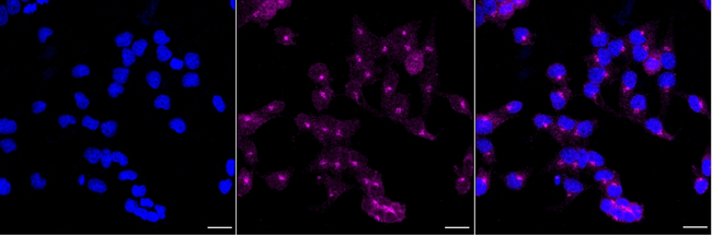 Fibrinogen alpha chain Antibody in Immunocytochemistry (ICC/IF)