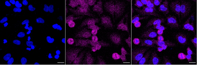 FHIT Antibody in Immunocytochemistry (ICC/IF)