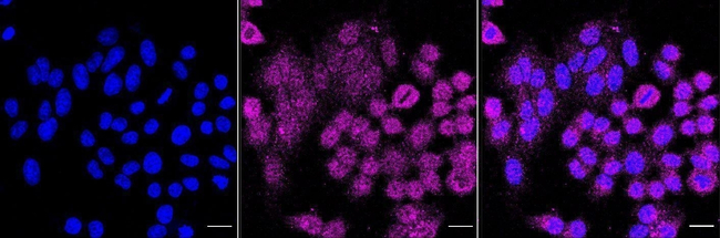 GABARAP Antibody in Immunocytochemistry (ICC/IF)