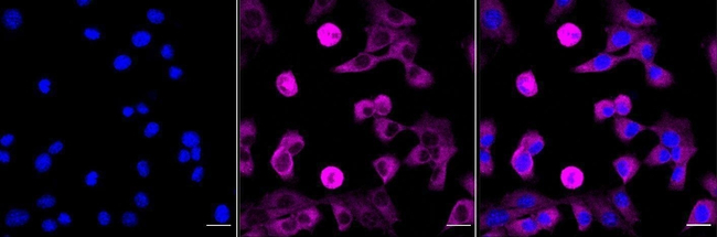GABBR1 Antibody in Immunocytochemistry (ICC/IF)