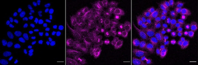GABRA5 Antibody in Immunocytochemistry (ICC/IF)