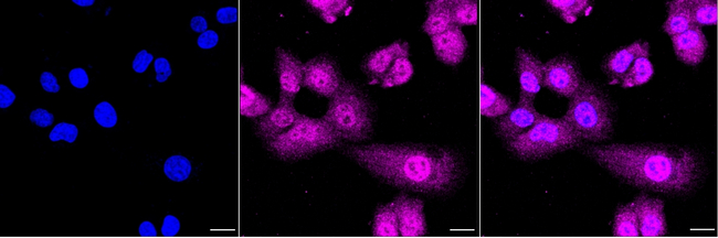 GATA6 Antibody in Immunocytochemistry (ICC/IF)