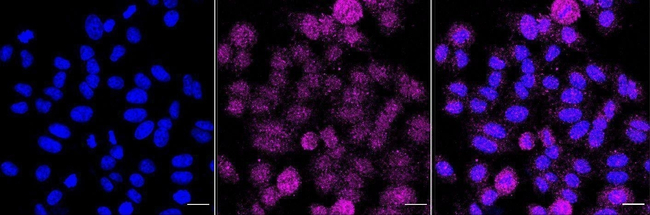GBP1 Antibody in Immunocytochemistry (ICC/IF)