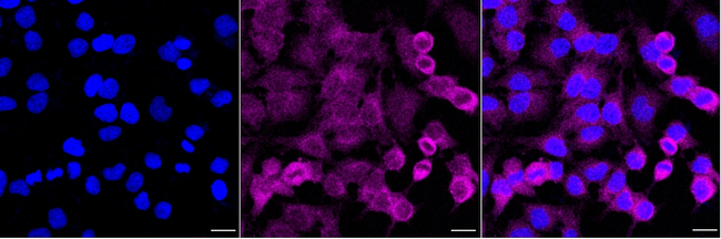 GNE Antibody in Immunocytochemistry (ICC/IF)