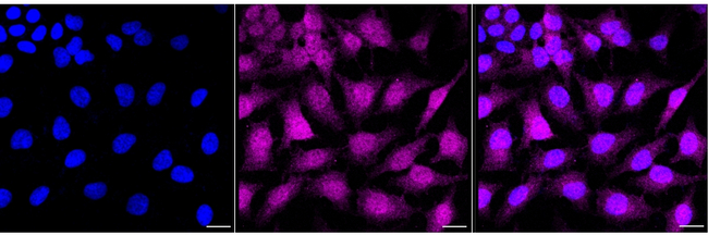 CDKN2C Antibody in Immunocytochemistry (ICC/IF)