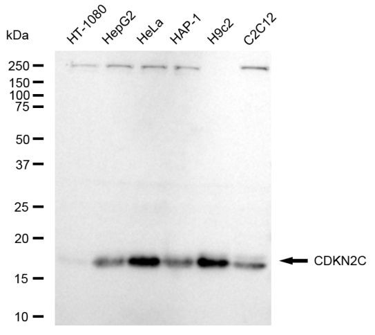 CDKN2C Antibody in Western Blot (WB)