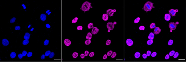 ALY Antibody in Immunocytochemistry (ICC/IF)