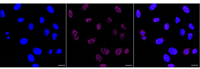 Cystatin A Antibody in Immunocytochemistry (ICC/IF)