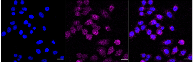 CXCL5 Antibody in Immunocytochemistry (ICC/IF)
