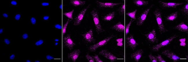 Complement C4 Antibody in Immunocytochemistry (ICC/IF)
