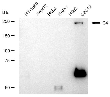 Complement C4 Antibody in Western Blot (WB)